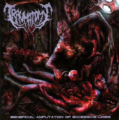 Traumatomy - Beneficial Amputation Of Excessive Limbs